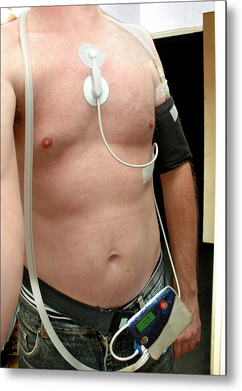 The Ambulatory Blood Pressure Monitor