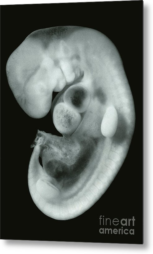 30 Day Old Metal Print featuring the photograph 30 Day Old Human Embryo #1 by Omikron