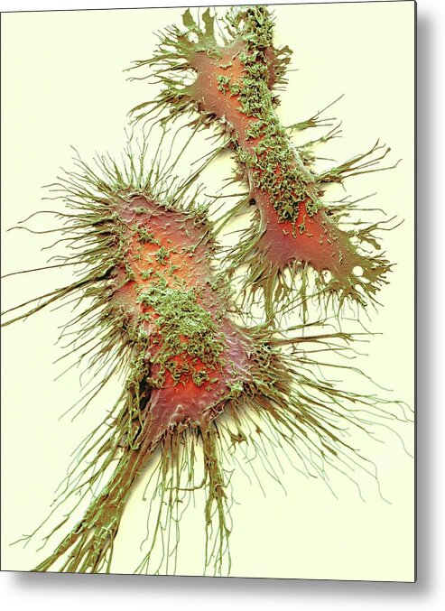 Anatomical Metal Print featuring the photograph Microglia #2 by Steve Gschmeissner