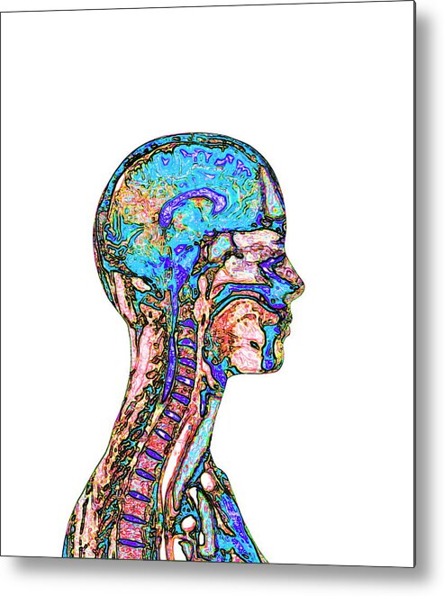 Brain Metal Print featuring the photograph Brain And Spinal Cord #3 by Mehau Kulyk