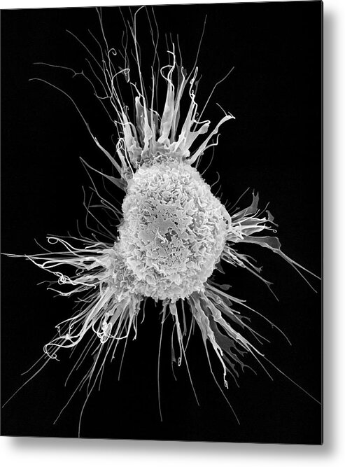 28798c Metal Print featuring the photograph Mouse Dendritic Cell #4 by Dennis Kunkel Microscopy/science Photo Library