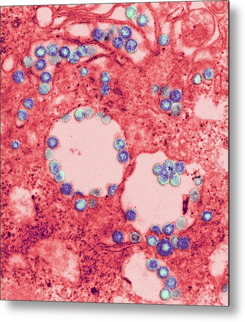Africa Metal Print featuring the photograph Rift Valley Fever Virus by Ami Images/f. A. Murphy; J. Dalrymple