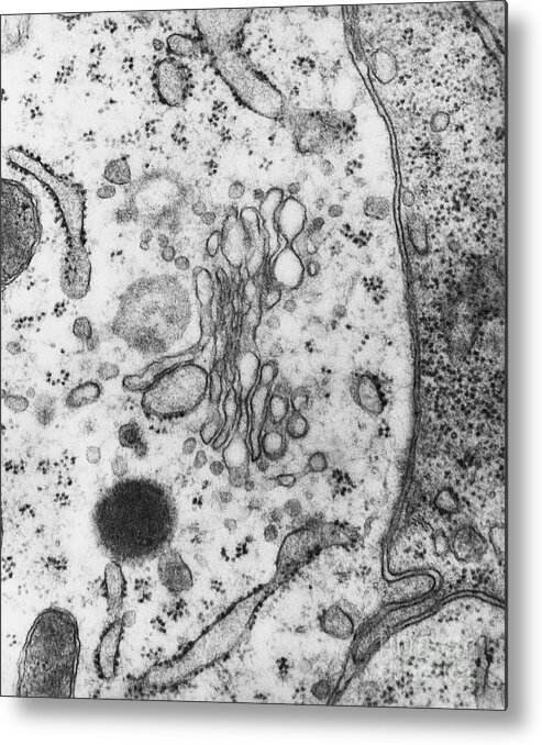 Eukaryote Metal Print featuring the photograph Lysosomes, Tem #3 by Science Source