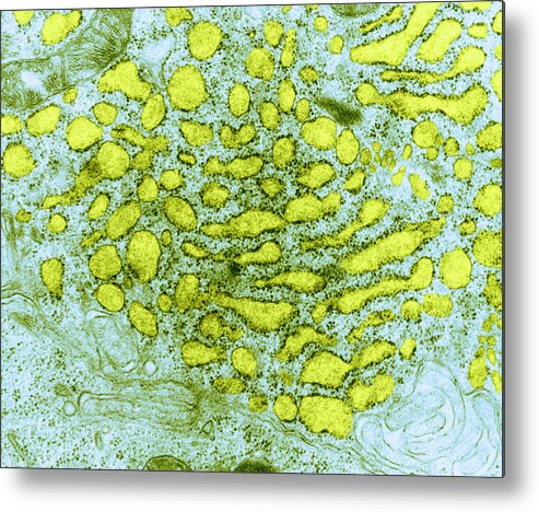 Eukaryote Metal Print featuring the photograph Endoplasmic Reticulum, Tem #1 by Science Source