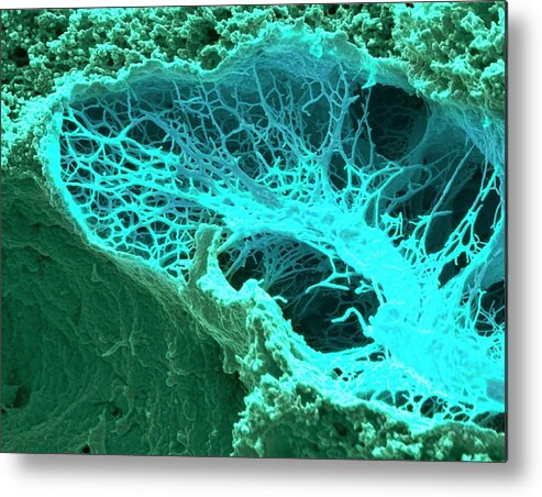 Coloured Metal Print featuring the photograph Slime Mould #1 by Steve Gschmeissner