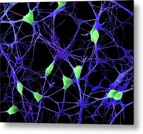 Central Nervous System Metal Print featuring the photograph Cortical Neurons #10 by Dennis Kunkel Microscopy/science Photo Library
