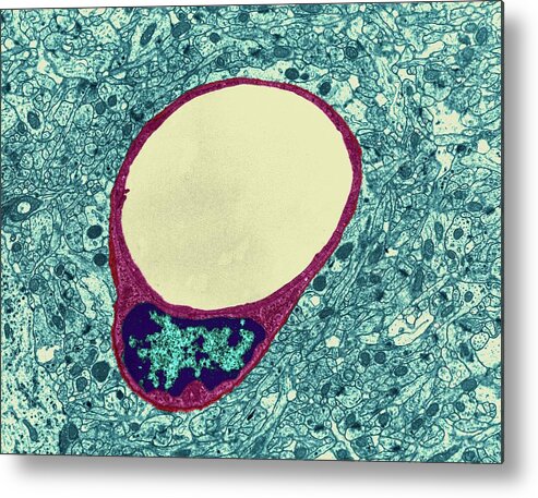 1957c Metal Print featuring the photograph Capillary And Endothelial Cell #2 by Dennis Kunkel Microscopy/science Photo Library