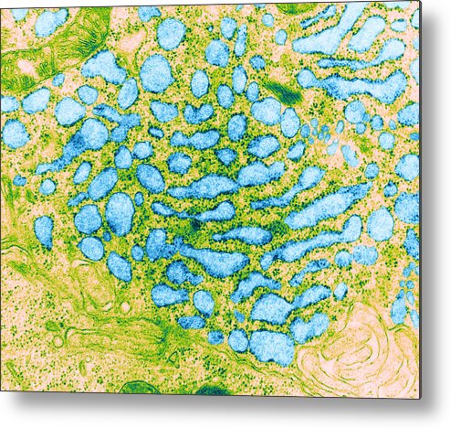 Eukaryote Metal Print featuring the photograph Endoplasmic Reticulum, Tem #2 by Science Source