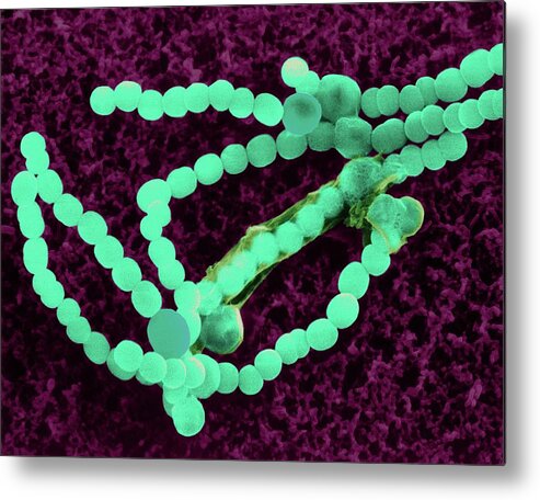 Bacteria Metal Print featuring the photograph Cyanobacterium (anabaena Sp.) #4 by Dennis Kunkel Microscopy/science Photo Library
