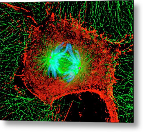 Magnified Image Metal Print featuring the photograph Mitosis Cell Division by Dr Alexey Khodjakov/science Photo Library