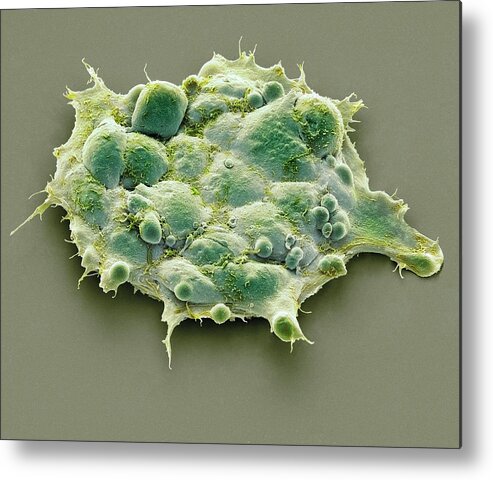 Biochemical Metal Print featuring the photograph Pluripotent Stem Cells #6 by Steve Gschmeissner