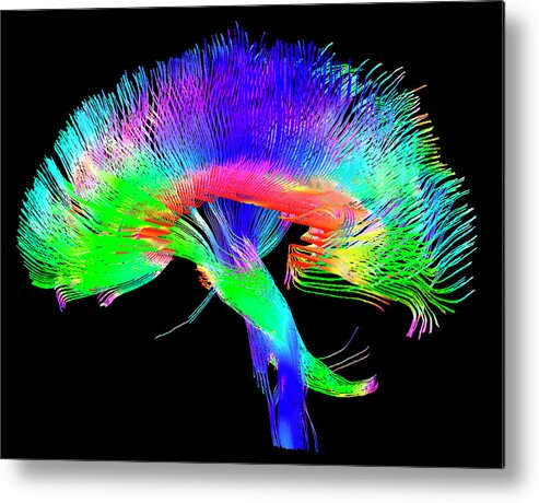 White Matter Metal Print featuring the photograph Brain Pathways by Tom Barrick, Chris Clark, Sghms