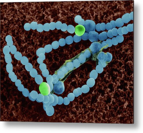 Nostocales Metal Print featuring the photograph Cyanobacterium (anabaena Sp.) by Dennis Kunkel Microscopy/science Photo Library