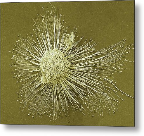 Biochemical Metal Print featuring the photograph Induced Pluripotent Stem Cell by Thomas Deerinck, Ncmir/science Photo Library
