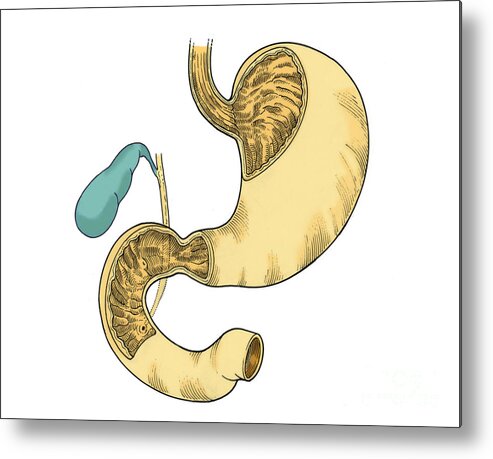 Anatomy Metal Print featuring the photograph Illustration Of Stomach And Duodenum #3 by Science Source