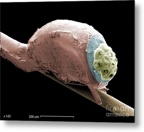 Scanning Electron Micrograph Metal Print featuring the photograph Sem Of A Head Lice Eggs by Ted Kinsman