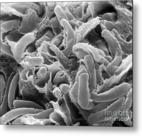 Science Metal Print featuring the photograph Kefir Bacteria by Scimat
