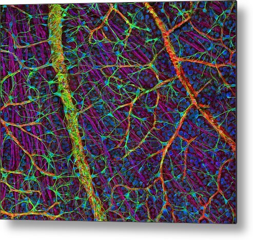 Eye Metal Print featuring the photograph Retina Blood Vessels And Nerve Cells by Thomas Deerinck, Ncmir