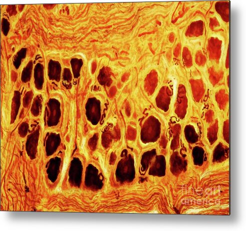 Axon Metal Print featuring the photograph Dorsal Root Ganglion #4 by Jose Calvo / Science Photo Library