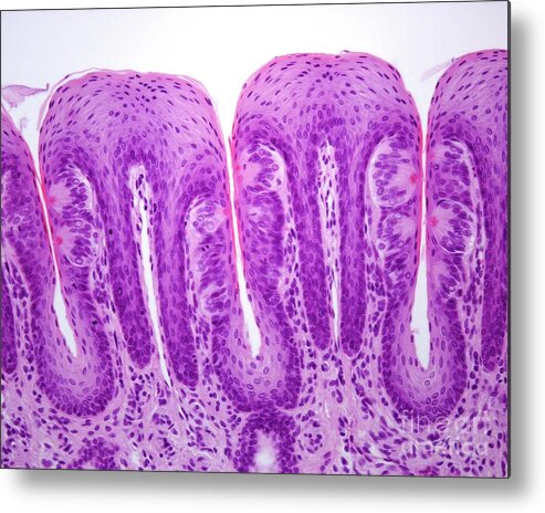 Tongue Metal Print featuring the photograph Foliate Papillae With Taste Buds #5 by Jose Calvo / Science Photo Library