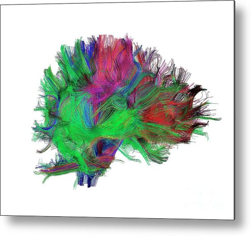 Brain Metal Print featuring the photograph Brain Fibres Side View Right by Do Tromp/science Photo Library