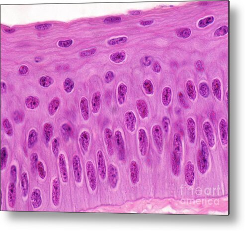 Bowman Layer Metal Print featuring the photograph Cornea Epithelium by Jose Calvo / Science Photo Library