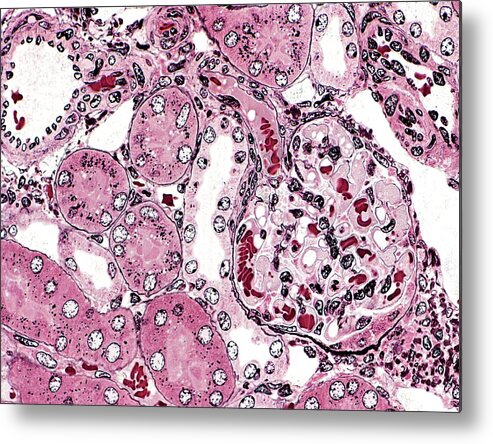 Glomerulus Metal Print featuring the photograph Renal Corpuscle #1 by Microscape