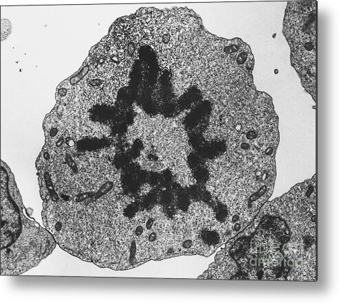 Eukaryote Metal Print featuring the photograph Mitosis, Metaphase, Tem #2 by David M. Phillips