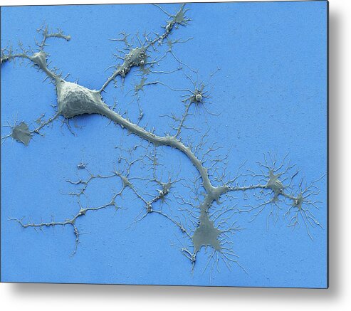 Axon Metal Print featuring the photograph Stem Cell-derived Neuron #3 by Thomas Deerinck, Ncmir/science Photo Library
