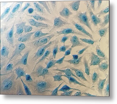 Anatomical Metal Print featuring the photograph Hela Cells #4 by Heiti Paves