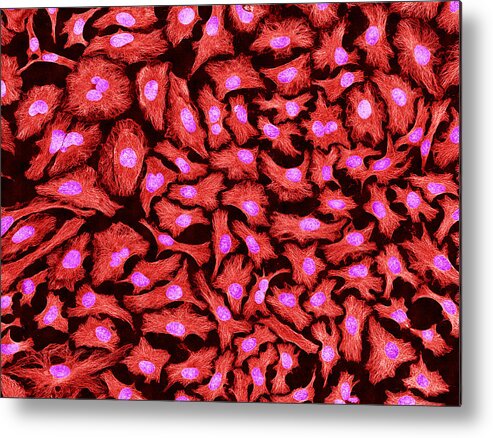 Science Metal Print featuring the photograph Hela Cells, Mfm #4 by Science Source