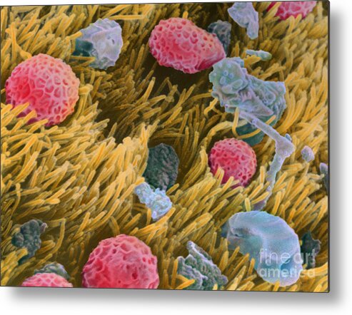 Allergens On Surface Of Trachea Metal Print featuring the photograph Allergens on surface of trachea by Spl
