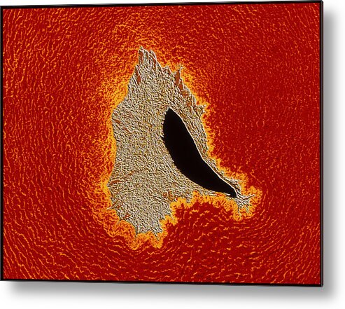 Magnified Image Metal Print featuring the photograph Atherosclerosis by Pasieka