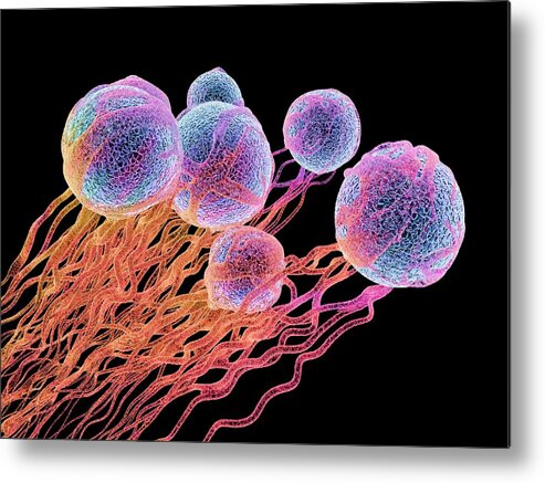Microvillus Metal Print featuring the drawing Cancer cells, illustration by Alfred Pasieka/science Photo Library