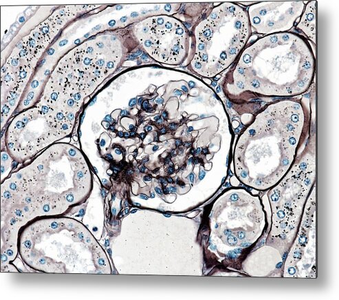 Glomerulus Metal Print featuring the photograph Glomerulus by Microscape