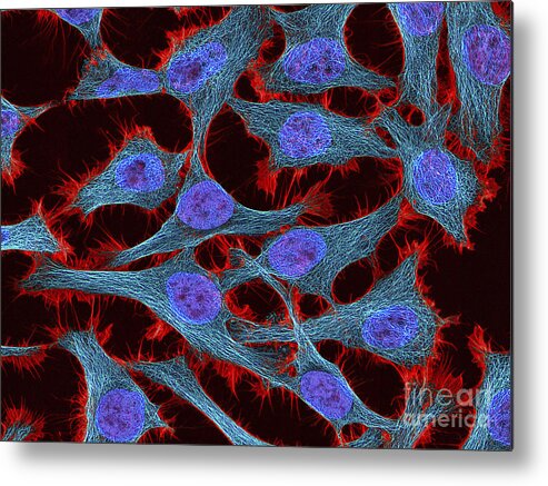 Horizontal Metal Print featuring the photograph Multiphoton Fluorescence Image Of Hela by National Institutes of Health