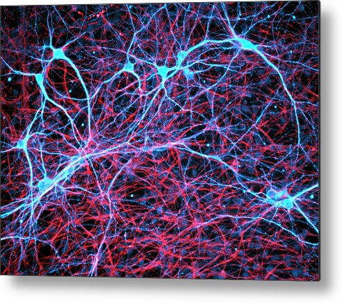 Cell Metal Print featuring the photograph Nerve And Glial Cells by Daniel Schroen, Cell Applications Inc