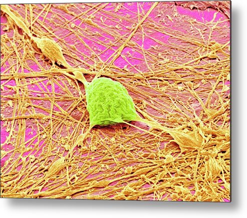 Neuron Metal Print featuring the photograph Nervous System Cells by Susumu Nishinaga