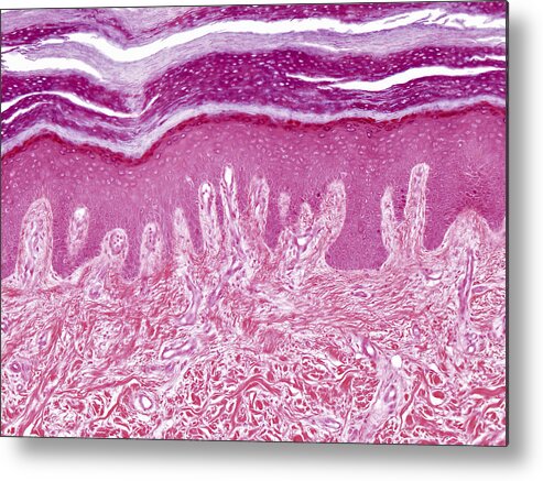 Skin Metal Print featuring the photograph Plantar Skin, Lm by Alvin Telser
