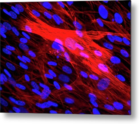 Cell Metal Print featuring the photograph Skeletal Muscle Cells by Daniel Schroen, Cell Applications Inc