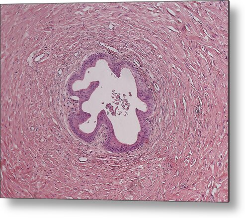 Vas Deferens Metal Print featuring the photograph Vas Deferens Cross Section, Lm by Science Stock Photography