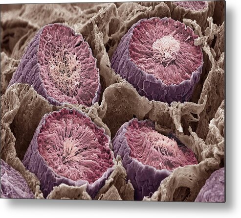Spermatozoon Metal Print featuring the photograph Sperm Production, Sem #3 by Steve Gschmeissner