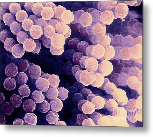 Fungi Metal Print featuring the Aspergillus #5 by Science Source