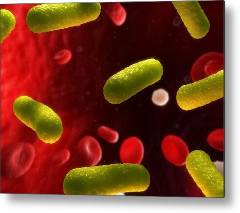 Artwork Metal Print featuring the photograph Bacterial Infection, Artwork by Sciepro