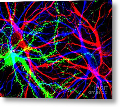Science Metal Print featuring the photograph Brain Cells In The Hippocampus by Science Source
