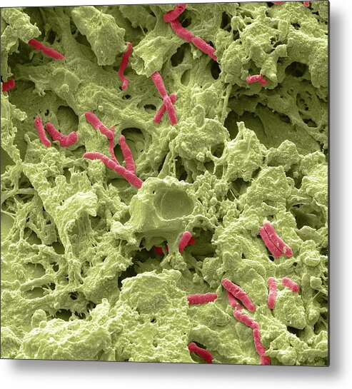 Pseudomonas Aeruginosa Metal Print featuring the photograph Pseudomonas Lung Infection #1 by Steve Gschmeissner