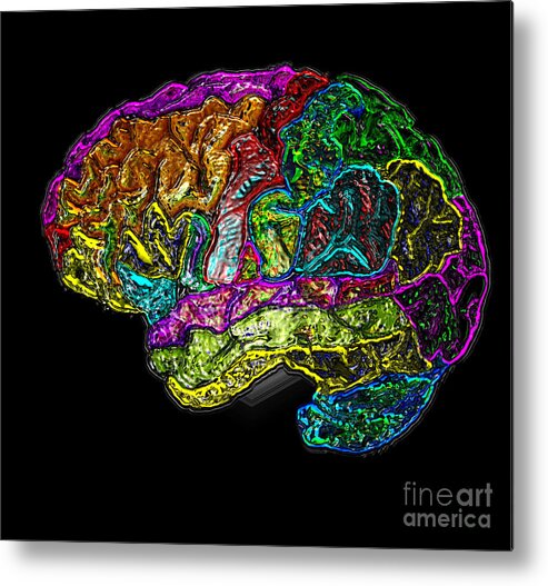 Science Metal Print featuring the photograph Mri Of Normal Brain #10 by Living Art Enterprises