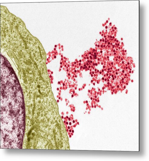 Burkett'ss Lymphoma Metal Print featuring the photograph Epstein-barr Virus by Steve Gschmeissner