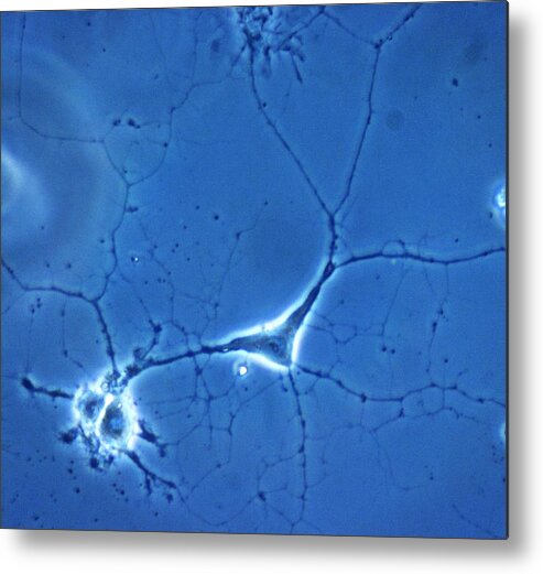 Cytology Metal Print featuring the photograph Brain Cells, Light Micrograph #2 by Riccardo Cassiani-ingoni