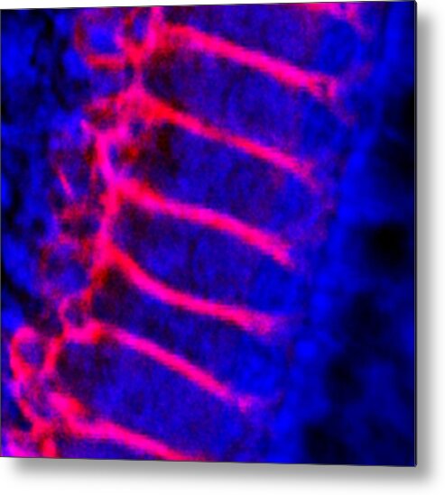 Glast Metal Print featuring the photograph Inner Ear Hair Cells, Light Micrograph by Dr David Furness, Keele University